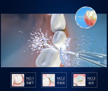 光靠刷牙解决不了牙齿困扰！冲牙器排行榜帮助你