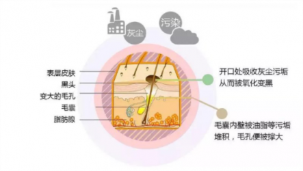 让你的黑头全退散！黑头仪有用吗？