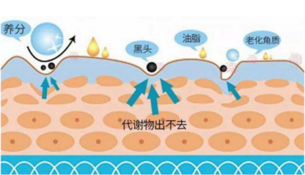 去掉黑头你就是下一个林志玲！黑头仪哪个牌子好？