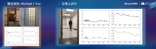 腾讯医疗人工智能研究院院长范伟：超越认知，AI重塑运动评估