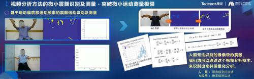 腾讯医疗人工智能研究院院长范伟：超越认知，AI重塑运动评估