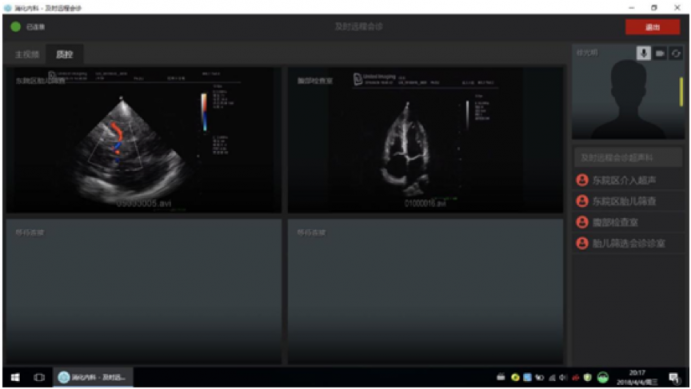讯众及时会视频云助推协和医院医疗信息化建设