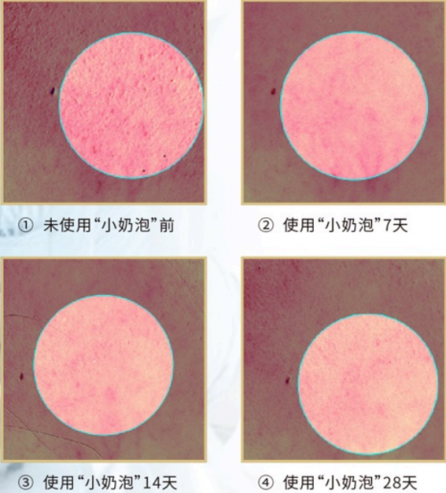 美内“小奶泡”，最简单的洁面产品你选对了吗？