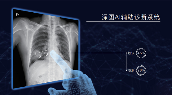 新品上市，高端之选，深图300Mars悬吊DR闪耀发布