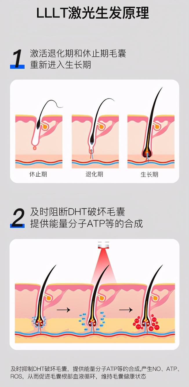 LLLT低能量激光生发仪，内置81颗激光器