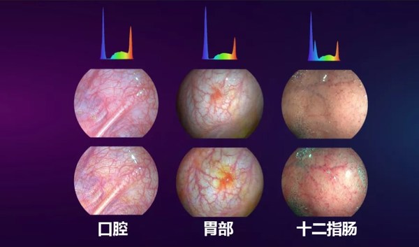 光随影动 开立医疗国产内镜功能领跑智能新方向