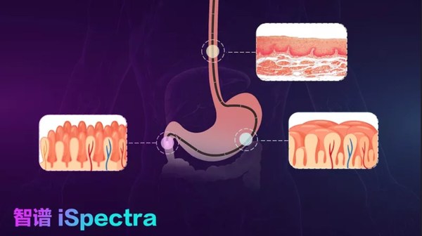 光随影动 开立医疗国产内镜功能领跑智能新方向