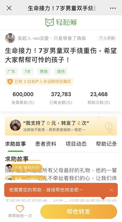 生命接力！轻松筹上爱心汇聚，帮助被生父烧伤的可怜男童重获新生