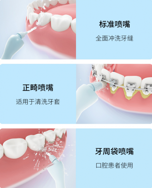 众筹价仅269元！素诺智能可视冲牙器C3 pro小米有品众筹开抢