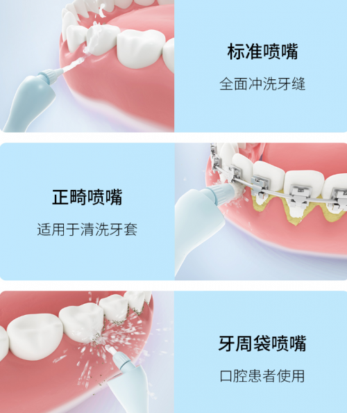 正畸人士福音！素诺智能可视冲牙器C3 pro看得清，冲得净