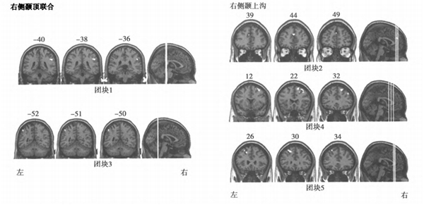 金博智慧褚明礼：孩子有注意缺陷、多动障碍，家长需警惕孤独症影响