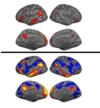 金博智慧褚明礼：经颅直流电刺激（tDCS）改善孤独症儿童社交、认知的脑科学证据