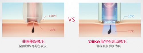 Ulike脱毛仪：消费驱动千亿发展空间的脱毛市场