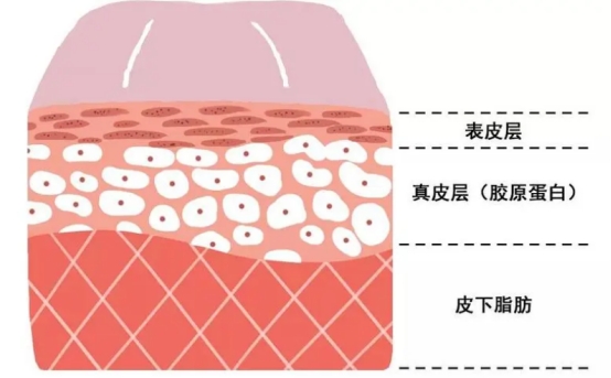 不做表面功夫，润致娃娃针+分层抗衰让你年龄满40减20